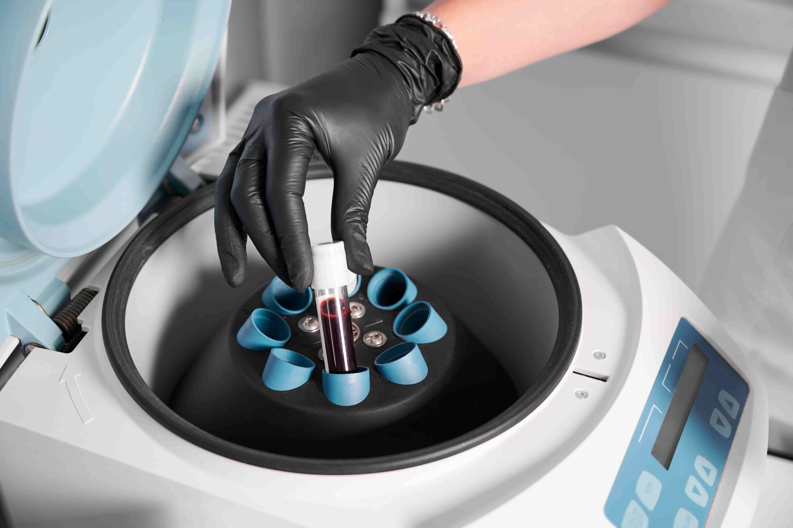Purificação de proteínas com amostra em tubo sendo colocada em centrífuga de laboratório